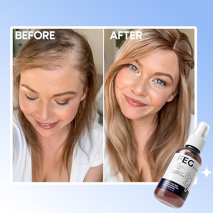 FEG Plus Hair Growth Spray Anti Hair Loss Treatment with Anagain, Procapil & Seaweed Extract